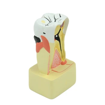 Модель пародонта Модель зубов для стоматологической патологии из ПВХ для обучения стоматологов на челноке